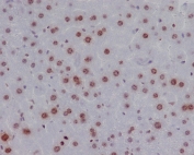 IHC testing of FFPE mouse liver with phospho-Histone H2AX antibody. HIER: boil tissue sections in pH6, 10mM citrate buffer, for 10-20 min followed by cooling at RT for 20 min.