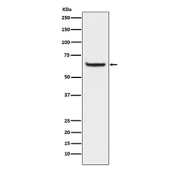 Phospho-NF-kB p65 Antibody HeLa WB. Western blot analysis of human HeLa cell lysate treated with Calyculin A and TNF-alpha using phospho-NF-kB p65 antibody detecting p65 phosphorylated at Ser529, clone AbN84. A band is observed at approximately 65-70 kDa, consistent with the predicted molecular weight of p65. Detection under stimulation conditions is consistent with phosphorylation-associated activation of NF-kB signaling.