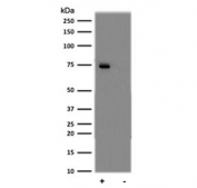 Western blot testing of treated (Calyculin A + TNF-alpha) and untreated human Daudi cell lysate with phospho-p65 antibody.