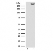 Western blot testing of lambda phosphatase treated and untreated human MCF7 cell lysate with phospho-POLR2A antibody. Predicted molecular weight 200-220 kDa but commonly observed at 250-270 kDa.