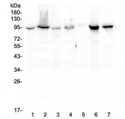 Western blot testing of human 1) HeLa, 2) COLO-320, 3) HepG2, 4) MCF7, 5) SW620, 6) 22RV1 and 7) Jurkat lysate with Beta Catenin antibody. Predicted molecular weight ~85 kDa, but routinely observed at 90-95 kDa.