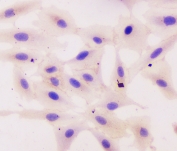 ICC testing of human A549 cells with Beta Catenin antibody.