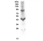 Western blot testing of human placental lysate with ITGB2 antibody at 1ug/ml. Expected molecular weight: 85~95 kDa depending on glycosylation level.