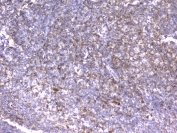 IHC testing of FFPE human tonsil tissue with ITGB2 antibody at 2ug/ml. HIER: boil tissue sections in pH6, 10mM citrate buffer, for 10-20 min followed by cooling at RT for 20 min.