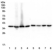 Western blot testing of human 1) HeLa, 2) MCF7, 3) COLO-320, 4) HepG2, 5) A549, 6) PANC-1, 7) 22RV1 and 8) MDA-MB-453 lysate with APE1 antibody at 1ug/ml. Predicted molecular weight ~38 kDa.