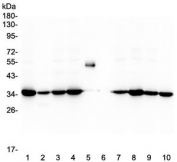Western blot testing of human 1) HeLa, 2) placenta, 3) Caco-2, 4) HepG2, 5) Rabbit IgG, 6) marker, 7) Jurkat, 8) MDA-MB-453, 9) SK-OV-3 and 10) U-87 MG lysate with Emerin antibody at 0.5ug/ml. Expected molecular weight: 29-34 kDa.
