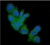 Immunofluorescent staining of FFPE human MCF7 cells with FHIT antibody (green) and DAPI nuclear stain (blue). HIER: steam section in pH6 citrate buffer for 20 min.