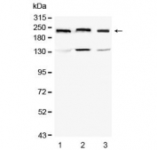 Western blot testing of human 1) HEK293T, 2) HeLa and 3) A549 cell lysate with Collagen IV antibody at 0.5ug/ml. Predicted molecular weight ~160 kDa but may be observed at a larger size due to glycosylation.