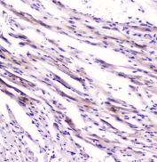 IHC testing of FFPE rat heart tissue with FABP3 antibody at 1ug/ml. HIER: boil tissue sections in pH6, 10mM citrate buffer, for 10-20 min followed by cooling at RT for 20 min.