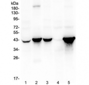 Western blot testing of human 1) HeLa, 2) placenta, 3) SK-OV-3, 4) COLO-320 and 5) SW620 lysate with Cytokeratin 19 antibody at 0.5ug/ml. Predicted molecular weight ~43 kDa.