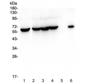 Western blot testing of human 1) HeLa, 2) MCF7, 3) COLO-320, 4) HepG2, 5) A431 and 6) HT-1080 cell lysate with TCP1 alpha antibody at 0.5ug/ml. Predicted molecular weight ~60 kDa.