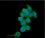 Immunofluorescent staining of FFPE human MCF7 cells with TCP1 alpha antibody (green) and DAPI nuclear stain (blue). HIER: steam section in pH6 citrate buffer for 20 min.