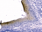 IHC testing of FFPE human tonsil tissue with Stefin B antibody at 2ug/ml. HIER: boil tissue sections in pH6, 10mM citrate buffer, for 10-20 min followed by cooling at RT for 20 min.