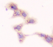 ICC testing of FFPE human A431 cells with SMN1/2 antibody. HIER: boil tissue sections in pH6, 10mM citrate buffer, for 10-20 min followed by cooling at RT for 20 min.