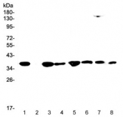 Western blot testing of human 1) HeLa, 2) placenta, 3) SW620, 4) PANC-1, 5) HepG2, 6) A549, 7) rat RH35 and 8) mouse HEPA1-6 lysate with SMN1/2 antibody at 0.5ug/ml. Expected molecular weight: 32-38 kDa.
