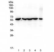 Western blot testing of human 1) HeLa, 2) MCF7, 3) COLO-320, 4) HepG2 and 5) HT-1080 cell lysate with CCT3 antibody at 0.5ug/ml. Predicted molecular weight ~61 kDa.