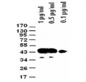 Western blot test of FLAG-tagged protein with different concentrations of FLAG tag antibody.