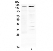 Western blot testing of human 1) THP-1 and 2) A375 cell lysate with P Glycoprotein antibody at 0.5ug/ml. Expected molecular weight: 141-180 kDa depending on glycosylation level.