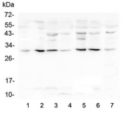 Western blot testing of human 1) placenta 2) HL-60, 3) Caco-2, 4) T-47D, 5) K562, 6) HepG2 and 7) A431 lysate with RPS3 antibody at 0.5ug/ml. Predicted molecular weight ~27 kDa.