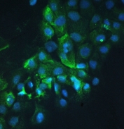 IF/ICC staining of FFPE human A431 cells with Cortactin antibody at 1ug/ml. HIER: boil tissue sections in pH6, 10mM citrate buffer, for 10-20 min followed by cooling at RT for 20 min.