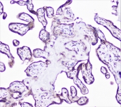 IHC staining of FFPE human placenta with Cortactin antibody at 1ug/ml. HIER: boil tissue sections in pH6, 10mM citrate buffer, for 10-20 min followed by cooling at RT for 20 min.