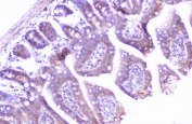 IHC staining of FFPE mouse intestine with Cortactin antibody at 1ug/ml. HIER: boil tissue sections in pH6, 10mM citrate buffer, for 10-20 min followed by cooling at RT for 20 min.