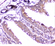 IHC staining of FFPE rat intestine with Cortactin antibody at 1ug/ml. HIER: boil tissue sections in pH6, 10mM citrate buffer, for 10-20 min followed by cooling at RT for 20 min.