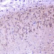 IHC staining of FFPE rat brain with Cortactin antibody at 1ug/ml. HIER: boil tissue sections in pH6, 10mM citrate buffer, for 10-20 min followed by cooling at RT for 20 min.