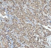 Western blot testing of human 1) K562, 2) A549, 3) HeLa, 4) A431, 5) rat brain and 6) mouse brain lysate with SP1 antibody. Expected molecular weight: 81-95 kDa.