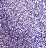 IHC staining of FFPE human tonsil with SP1 antibody at 1ug/ml. HIER: boil tissue sections in pH6, 10mM citrate buffer, for 10-20 min followed by cooling at RT for 20 min.