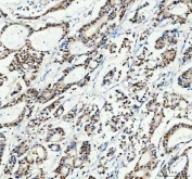 IHC staining of FFPE human tonsil with SP1 antibody at 1ug/ml. HIER: boil tissue sections in pH6, 10mM citrate buffer, for 10-20 min followed by cooling at RT for 20 min.