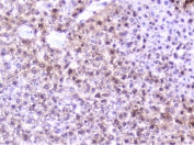 IHC staining of FFPE mouse liver with SP1 antibody at 1ug/ml. HIER: boil tissue sections in pH6, 10mM citrate buffer, for 10-20 min followed by cooling at RT for 20 min.