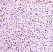 IHC staining of FFPE rat liver with SP1 antibody at 1ug/ml. HIER: boil tissue sections in pH6, 10mM citrate buffer, for 10-20 min followed by cooling at RT for 20 min.