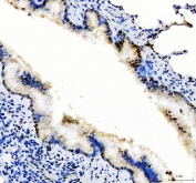 IHC staining of FFPE rat liver with SP1 antibody at 1ug/ml. HIER: boil tissue sections in pH6, 10mM citrate buffer, for 10-20 min followed by cooling at RT for 20 min.