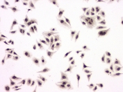 ICC staining of FFPE human HeLa cells with SP1 antibody at 1ug/ml. HIER: boil tissue sections in pH6, 10mM citrate buffer, for 10-20 min followed by cooling at RT for 20 min.