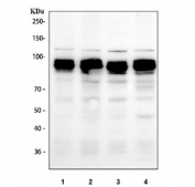 ICC staining of FFPE human HeLa cells with SP1 antibody at 1ug/ml. HIER: boil tissue sections in pH6, 10mM citrate buffer, for 10-20 min followed by cooling at RT for 20 min.