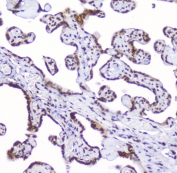 IHC staining of FFPE human placenta with AHR antibody at 1ug/ml. HIER: boil tissue sections in pH6, 10mM citrate buffer, for 10-20 min followed by cooling at RT for 20 min.