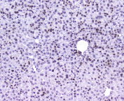 IHC staining of FFPE mouse liver with AHR antibody at 1ug/ml. HIER: boil tissue sections in pH6, 10mM citrate buffer, for 10-20 min followed by cooling at RT for 20 min.