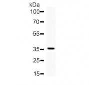 Western blot testing of human recombinant partial protein with AHR antibody.