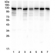 Western blot testing of human 1) HeLa, 2) HepG2, 3) A549, 4) PANC-1, 5) SK-OV-3, 6) SGC-7901 and 7) COLO-320 lysate with TMEM16A antibody at 0.5ug/ml. Expected molecular weight 74-114 kDa but may be observed at higher molecular weights due to glycosylation.