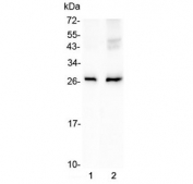 Western blot testing of 1) rat lung and 2) mouse lung lysate with AQP5 antibody at 0.5ug/ml. Predicted molecular weight ~28 kDa.