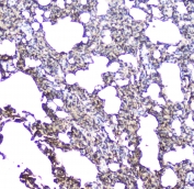 IHC staining of FFPE rat lung with AQP5 antibody at 1ug/ml. HIER: boil tissue sections in pH6, 10mM citrate buffer, for 10-20 min followed by cooling at RT for 20 min.