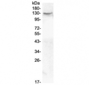 Western blot testing of human MCF7 cell lysate with CACNA2D2 antibody at 0.5ug/ml. Predicted molecular weight ~130 kDa.