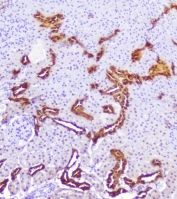 IHC staining of FFPE rat kidney with Calbindin antibody at 1ug/ml. HIER: boil tissue sections in pH6, 10mM citrate buffer, for 10-20 min followed by cooling at RT for 20 min.