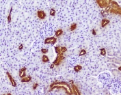 IHC staining of FFPE mouse kidney with Calbindin antibody at 1ug/ml. HIER: boil tissue sections in pH6, 10mM citrate buffer, for 10-20 min followed by cooling at RT for 20 min.