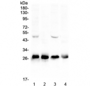 Western blot testing of 1) rat brain, 2) rat kidney, 3) mouse brain and 4) mouse kidney lysate with Calbindin antibody at 0.5ug/ml. Predicted molecular weight: ~30 kDa, routinely observed at 27-28 kDa.
