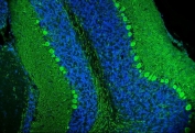 Immunofluorescent staining of FFPE rat cerebellum tissue with Calbindin antibody (green) and DAPI nuclear stain (blue). HIER: steam section in pH8 EDTA for 20 min.