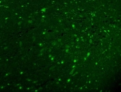 Immunofluorescent staining of FFPE rat cerebellum tissue with Calbindin antibody. HIER: steam section in pH8 EDTA for 20 min.