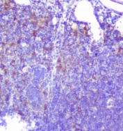IHC staining of FFPE mouse intestine with Caspase-2 antibody at 0.5ug/ml. HIER: boil tissue sections in pH6, 10mM citrate buffer, for 10-20 min followed by cooling at RT for 20 min.