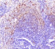 IHC staining of FFPE rat spleen with Caspase-2 antibody at 0.5ug/ml. HIER: boil tissue sections in pH6, 10mM citrate buffer, for 10-20 min followed by cooling at RT for 20 min.
